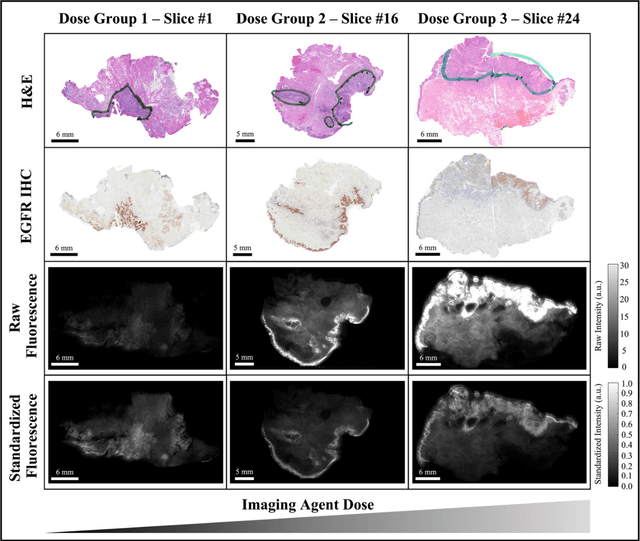 Figure 4 for Fluorescence molecular optomic signatures improve identification of tumors in head and neck specimens