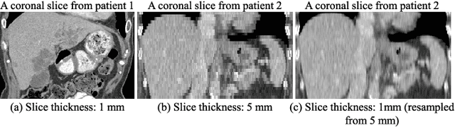 Figure 1 for Conquering Data Variations in Resolution: A Slice-Aware Multi-Branch Decoder Network