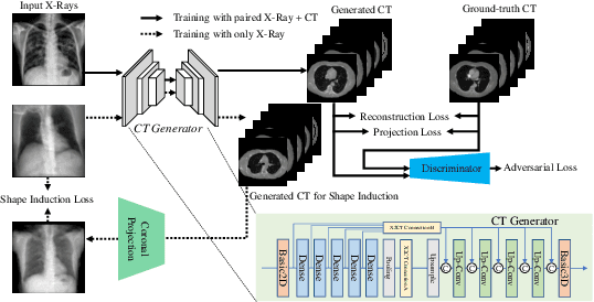 Figure 3 for Improving Computed Tomography (CT) Reconstruction via 3D Shape Induction