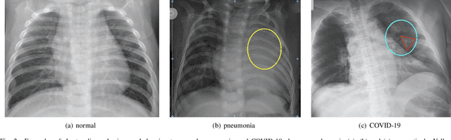 Figure 2 for Semi-supervised Learning for COVID-19 Image Classification via ResNet