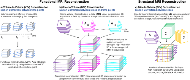 Figure 1 for Motion Correction and Volumetric Reconstruction for Fetal Functional Magnetic Resonance Imaging Data