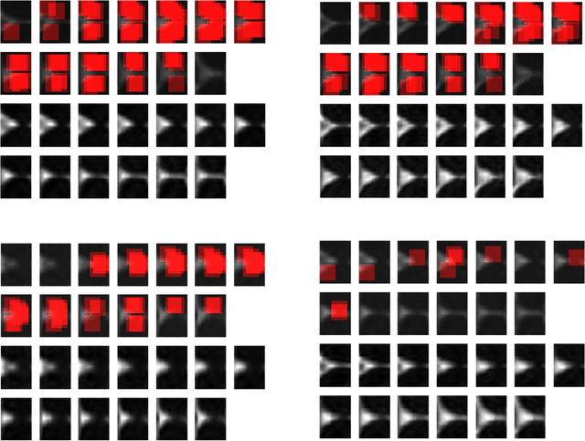 Figure 3 for MTBI Identification From Diffusion MR Images Using Bag of Adversarial Visual Features
