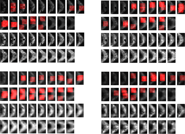 Figure 4 for MTBI Identification From Diffusion MR Images Using Bag of Adversarial Visual Features
