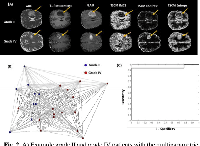Figure 3 for Multiparametric Deep Learning and Radiomics for Tumor Grading and Treatment Response Assessment of Brain Cancer: Preliminary Results