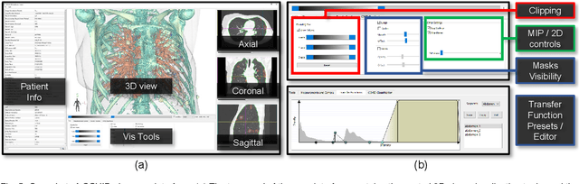 Figure 4 for COVID-view: Diagnosis of COVID-19 using Chest CT