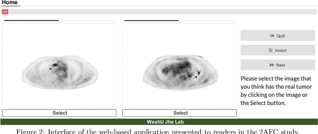 Figure 3 for Observer study-based evaluation of a stochastic and physics-based method to generate oncological PET images