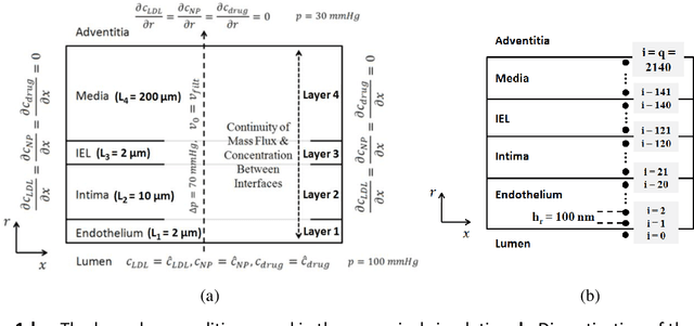 Figure 1 for Robust Control of Nanoscale Drug Delivery System in Atherosclerosis: A Mathematical Approach