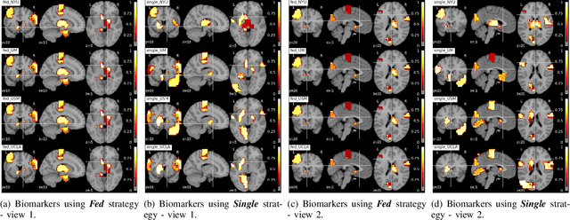 Figure 3 for Multi-site fMRI Analysis Using Privacy-preserving Federated Learning and Domain Adaptation: ABIDE Results