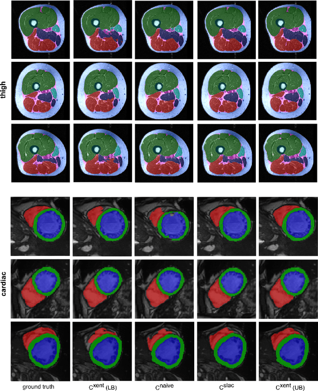Figure 4 for Combining Heterogeneously Labeled Datasets For Training Segmentation Networks