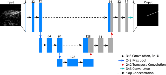 Figure 3 for Improving needle visibility in LED-based photoacoustic imaging using deep learning with semi-synthetic datasets