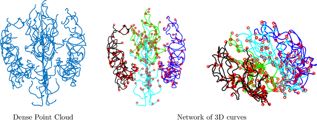 Figure 1 for Statistical shape analysis of brain arterial networks (BAN)