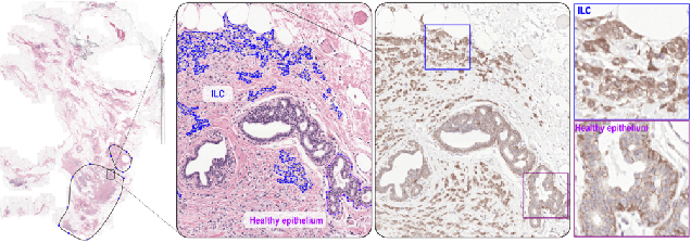Figure 3 for HookNet: multi-resolution convolutional neural networks for semantic segmentation in histopathology whole-slide images
