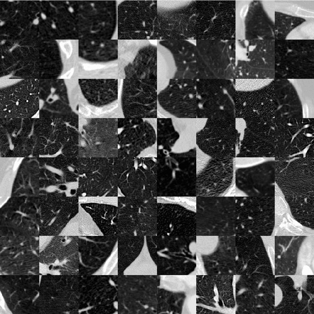 Figure 4 for Evaluation of 3D GANs for Lung Tissue Modelling in Pulmonary CT