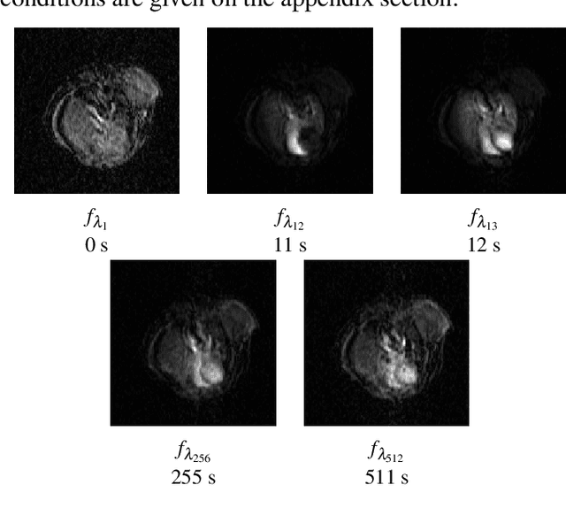 Figure 1 for Multivariate mathematical morphology for DCE-MRI image analysis in angiogenesis studies