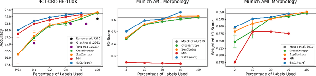 Figure 2 for S5CL: Unifying Fully-Supervised, Self-Supervised, and Semi-Supervised Learning Through Hierarchical Contrastive Learning