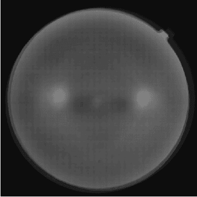 Figure 3 for Learned Pre-Processing for Automatic Diabetic Retinopathy Detection on Eye Fundus Images