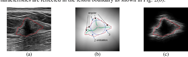 Figure 3 for Breast Ultrasound Computer-Aided Diagnosis Using Structure-Aware Triplet Path Networks