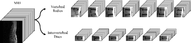 Figure 1 for Self-Supervised Learning for Spinal MRIs