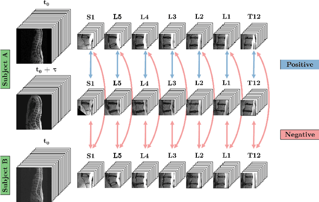 Figure 3 for Self-Supervised Learning for Spinal MRIs