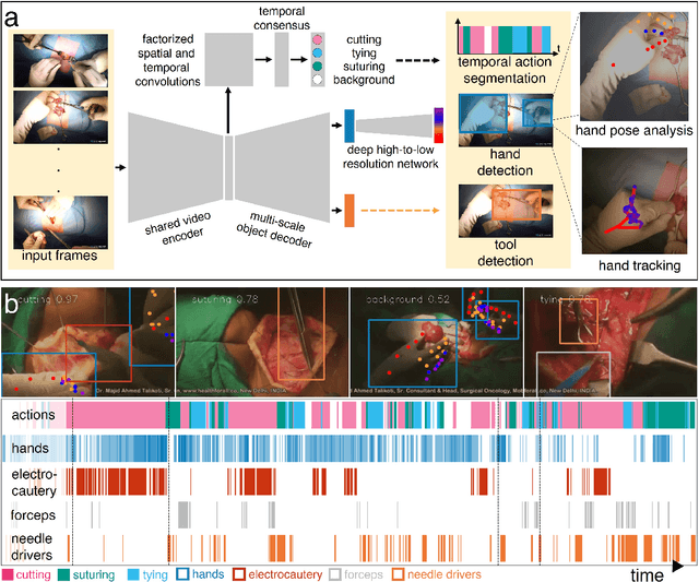 Figure 2 for A real-time spatiotemporal AI model analyzes skill in open surgical videos