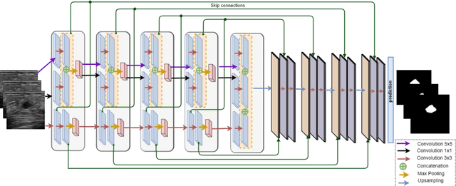 Figure 3 for Stan: Small tumor-aware network for breast ultrasound image segmentation