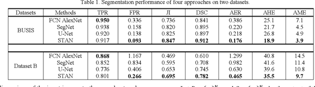 Figure 2 for Stan: Small tumor-aware network for breast ultrasound image segmentation