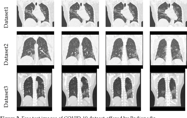 Figure 3 for Harmony-Search and Otsu based System for Coronavirus Disease  Detection using Lung CT Scan Images