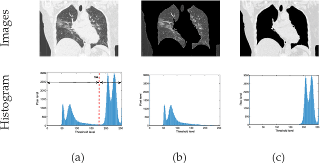 Figure 4 for Harmony-Search and Otsu based System for Coronavirus Disease  Detection using Lung CT Scan Images
