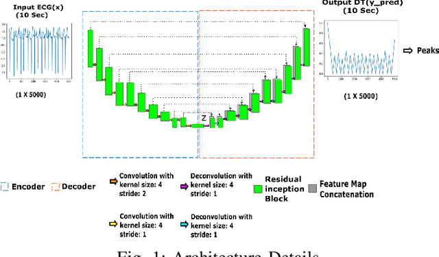 Figure 1 for RPnet: A Deep Learning approach for robust R Peak detection in noisy ECG