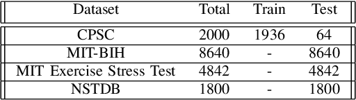 Figure 4 for RPnet: A Deep Learning approach for robust R Peak detection in noisy ECG