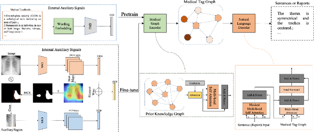 Figure 3 for Auxiliary Signal-Guided Knowledge Encoder-Decoder for Medical Report Generation