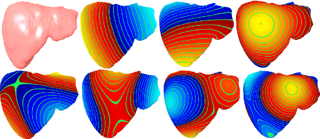 Figure 1 for Deep Shape Analysis on Abdominal Organs for Diabetes Prediction