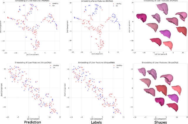 Figure 4 for Deep Shape Analysis on Abdominal Organs for Diabetes Prediction