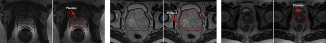Figure 1 for A weakly supervised registration-based framework for prostate segmentation via the combination of statistical shape model and CNN