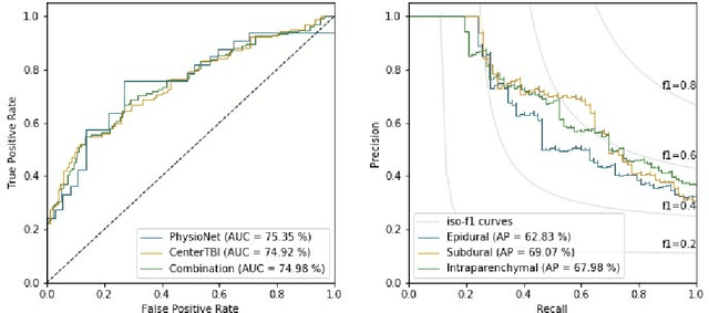 Figure 4 for Unsupervised 3D Brain Anomaly Detection