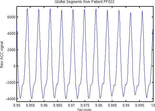 Figure 1 for Uncovering Voice Misuse Using Symbolic Mismatch