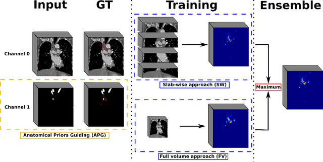 Figure 4 for Mediastinal lymph nodes segmentation using 3D convolutional neural network ensembles and anatomical priors guiding