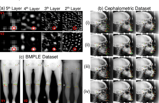 Figure 3 for Relative distance matters for one-shot landmark detection