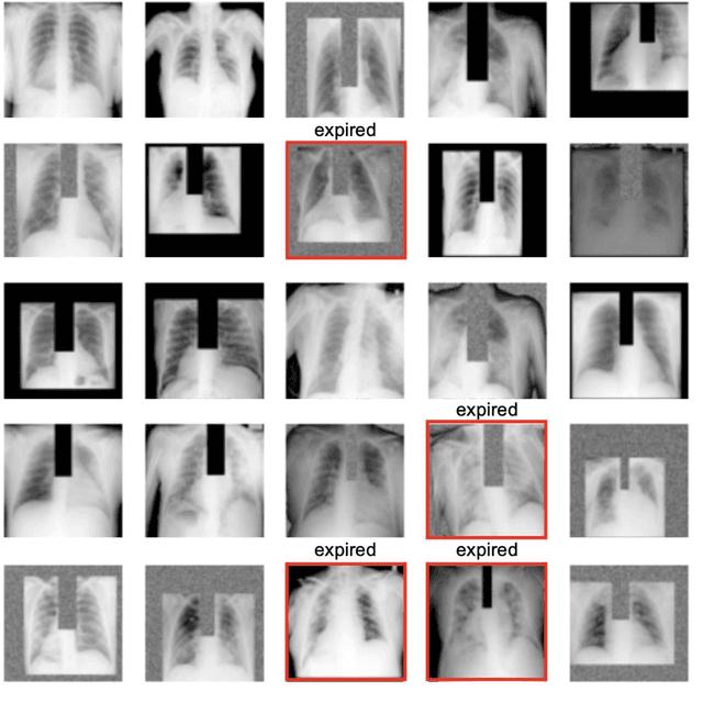 Figure 4 for Developing and validating multi-modal models for mortality prediction in COVID-19 patients: a multi-center retrospective study