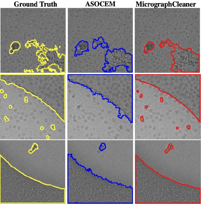 Figure 2 for ASOCEM: Automatic Segmentation Of Contaminations in cryo-EM