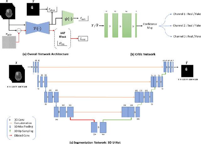 Figure 3 for Reciprocal Adversarial Learning for Brain Tumor Segmentation: A Solution to BraTS Challenge 2021 Segmentation Task