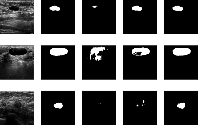 Figure 3 for Fine tuning U-Net for ultrasound image segmentation: which layers?