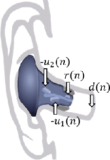 Figure 1 for Optimization of a Fixed Virtual Sensing Feedback ANC Controller for In-Ear Headphones with Multiple Loudspeakers