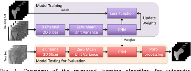 Figure 1 for Segmentation of the Proximal Femur from MR Images using Deep Convolutional Neural Networks
