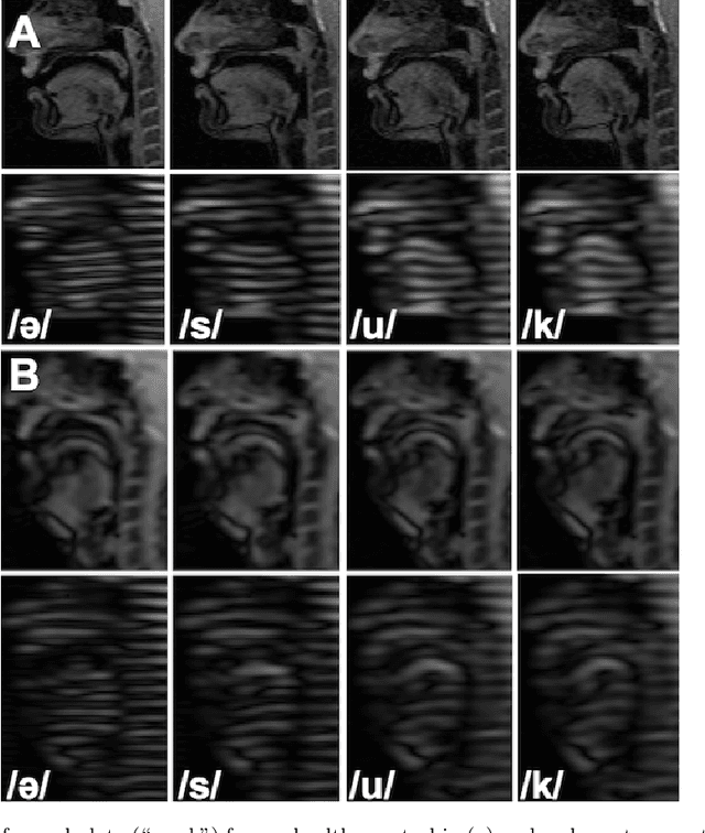 Figure 1 for Speech Map: A Statistical Multimodal Atlas of 4D Tongue Motion During Speech from Tagged and Cine MR Images