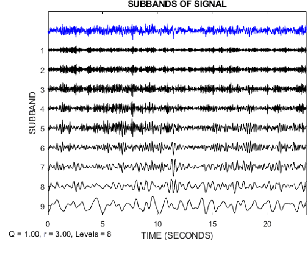Figure 2 for Detection of Epileptic Seizures on EEG Signals Using ANFIS Classifier, Autoencoders and Fuzzy Entropies