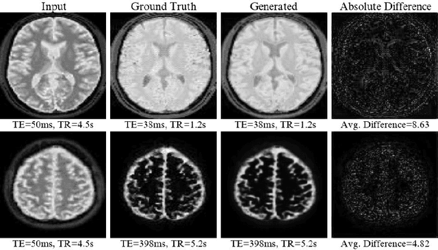 Figure 4 for Deep Learning-Based MR Image Re-parameterization