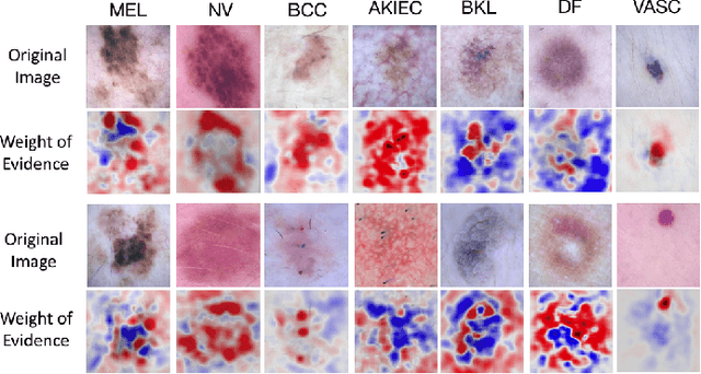 Figure 4 for What evidence does deep learning model use to classify Skin Lesions?