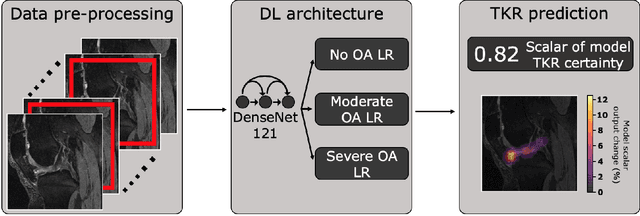 Figure 1 for Deep learning predicts total knee replacement from magnetic resonance images