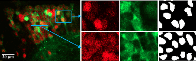 Figure 1 for Neuron Segmentation Using Deep Complete Bipartite Networks